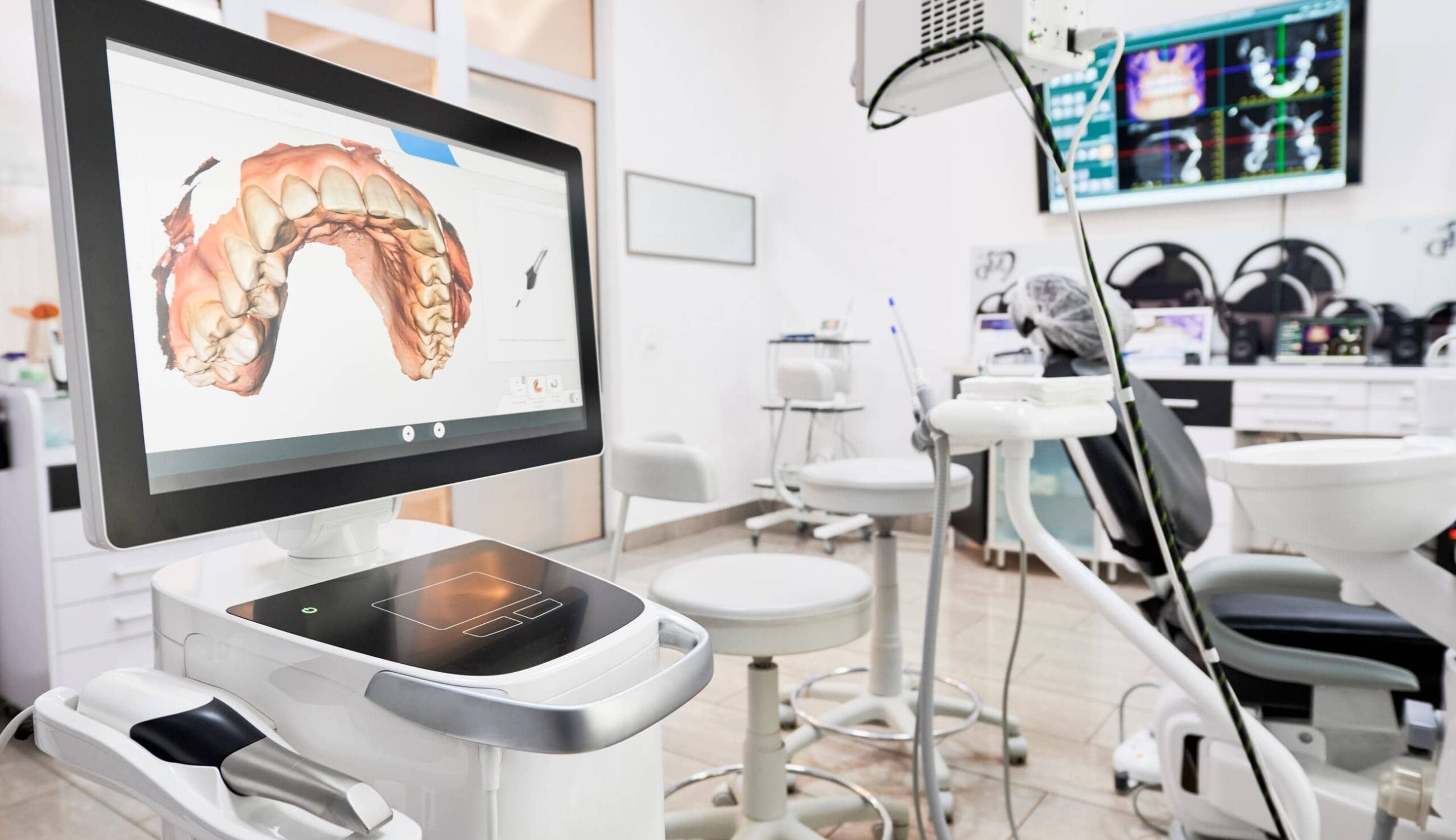 Le scanner numérique 3D : un allié pour la pose de prothèses dentaires | Clinique dentaire Sana Oris | Paris 8