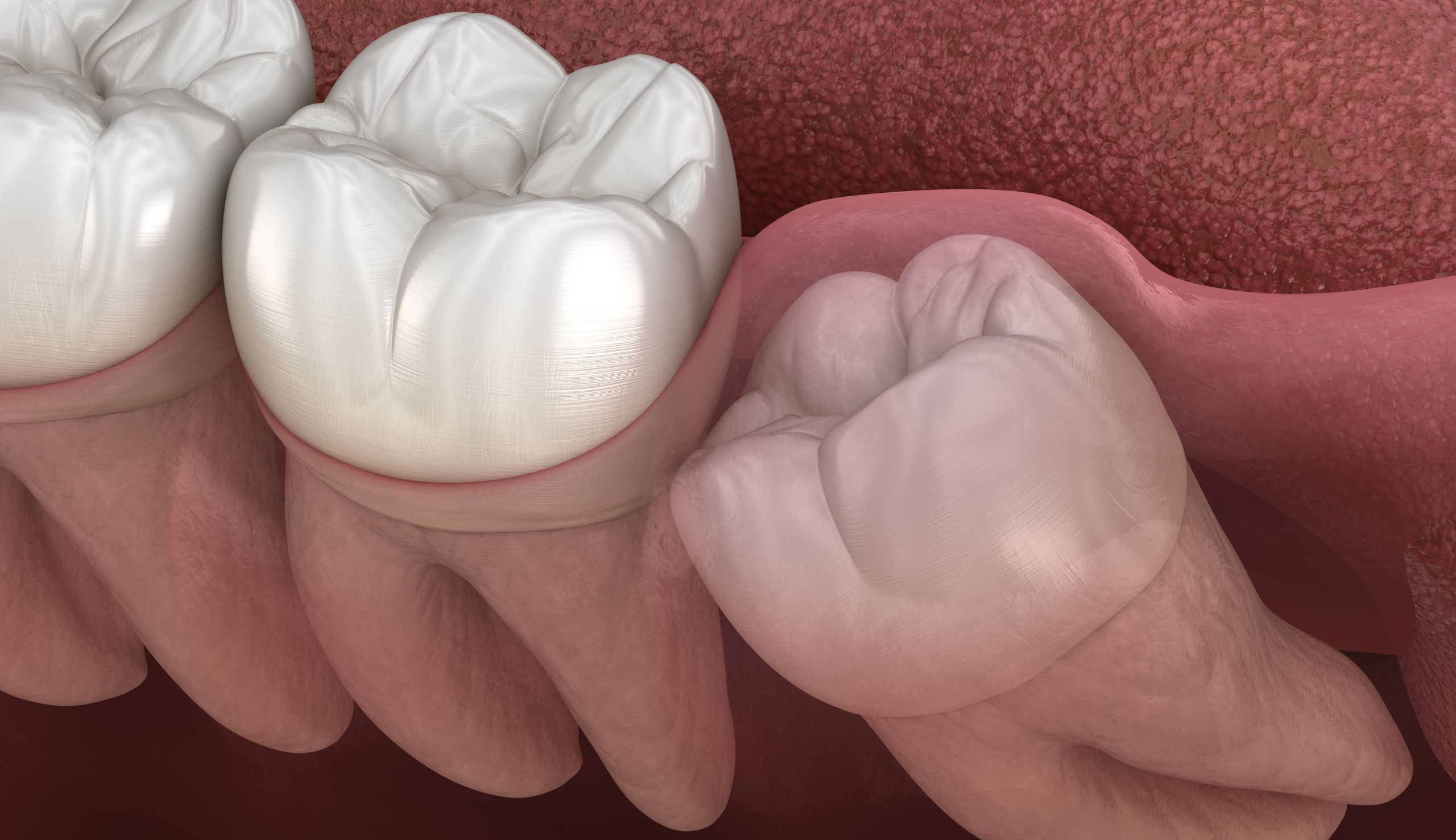 Les dents peuvent-elles bouger après un traitement orthodontique ? | Clinique dentaire Sana Oris | Paris